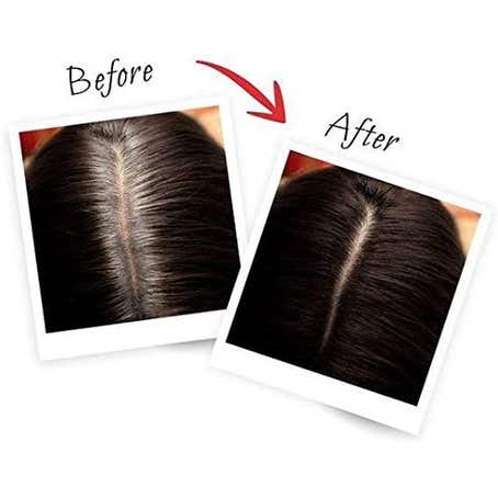 Hair Building Fibers-Black 12G