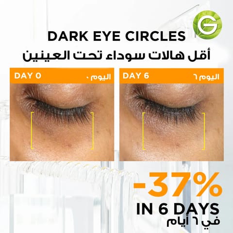 جل تخسيس شيب مي لشد وتشكيل الجسم من ايلين بيرين™