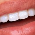 Tooth Gloss - Glostik