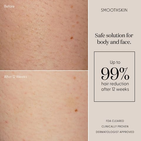 Beurer Ipl 9000+ Hair Removal