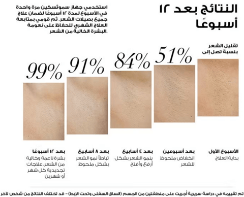 Beurer Ipl 9000+ Hair Removal