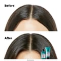 Lp Se Scalp Duo Eoy Set