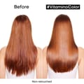 Lp Se Vitamino Trio Eoy Set