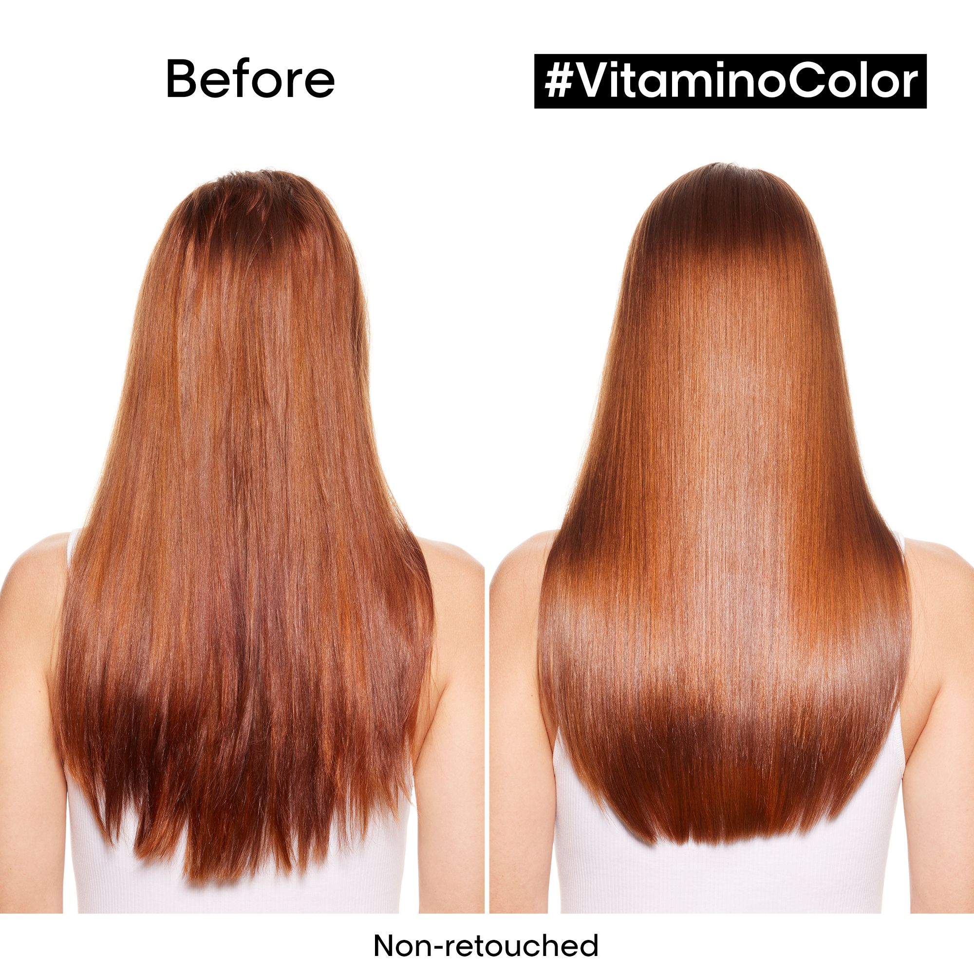 Lp Se Vitamino Trio Eoy Set